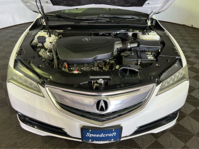 2016 Acura TLX V6 Advance